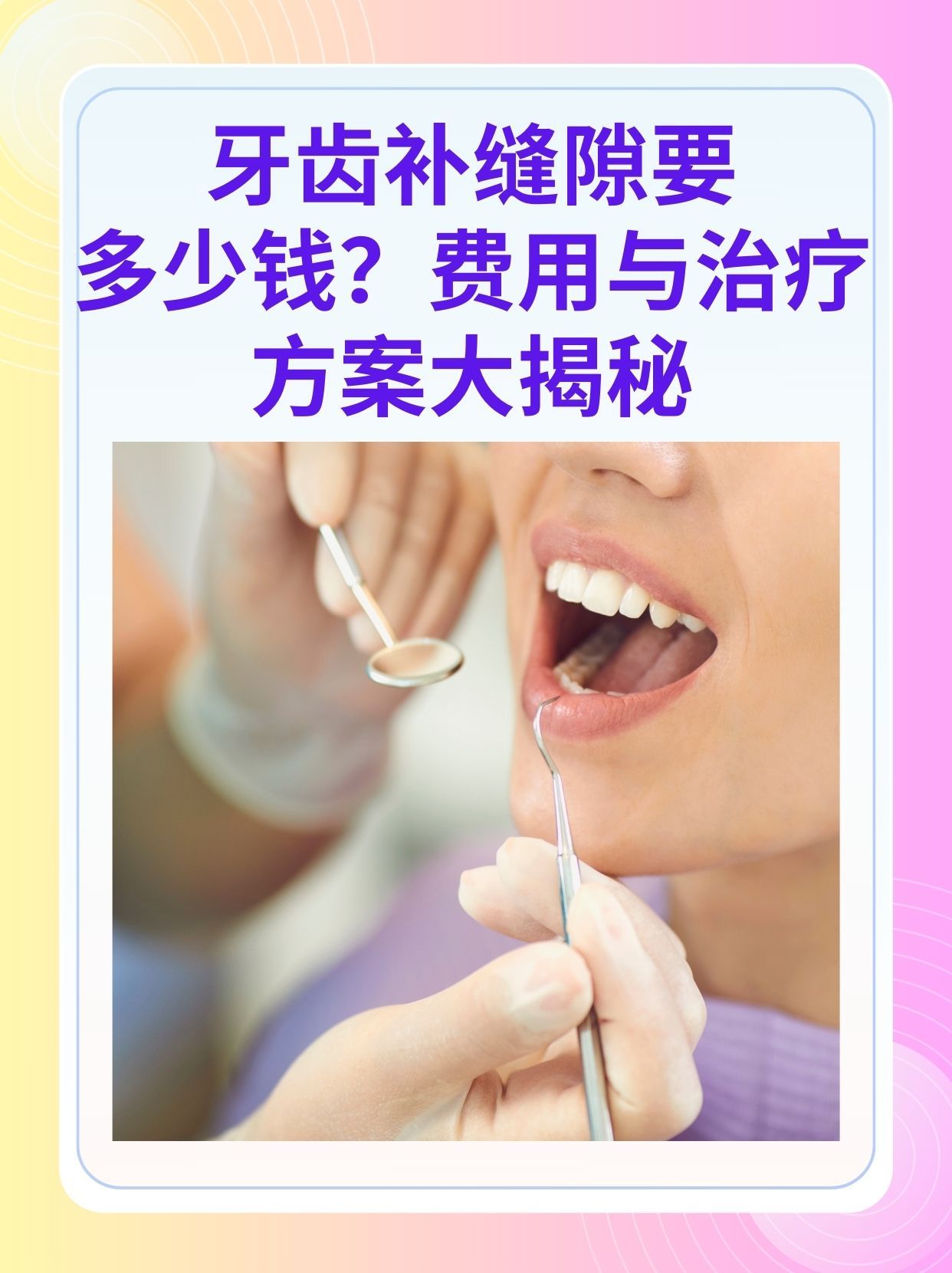 鸡西补牙医保可以报销吗(补牙医保可以报销吗 哪些可以报销呢)